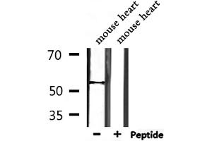 Western blot analysis of extracts from mouse heart, using TRMT11 Antibody. (Trmt11 anticorps  (C-Term))