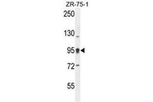 ACAP1 Antibody (N-term) western blot analysis in ZR-75-1 cell line lysates (35ug/lane).