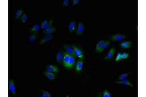 Immunofluorescent analysis of HepG2 cells using ABIN7173175 at dilution of 1:100 and Alexa Fluor 488-congugated AffiniPure Goat Anti-Rabbit IgG(H+L) (FAM70A anticorps  (AA 110-225))