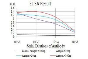 Black line: Control Antigen (100 ng),Purple line: Antigen (10 ng), Blue line: Antigen (50 ng), Red line:Antigen (100 ng) (IGHM anticorps  (AA 310-452))