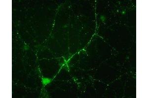 Immunostaining of cultured mouse caudate neurons showing synapsin I when phosphorylated at Ser549. (SYN1 anticorps  (pSer549))
