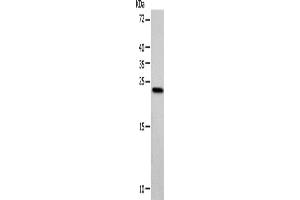Western blot analysis of Hela cells using VSNL1 Polyclonal Antibody at dilution of 1:900 (VSNL1 anticorps)