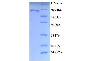 SDS-PAGE (SDS) image for K(lysine) Acetyltransferase 5 (KAT5) (AA 3-513), (partial) protein (His tag) (ABIN5713104)