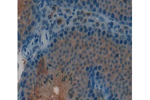 Used in DAB staining on fromalin fixed paraffin- embedded Kidney tissue (CGB anticorps  (AA 55-153))