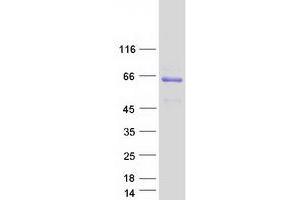 Validation with Western Blot