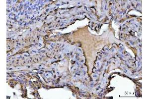 IHC analysis of PTRF/CAVIN1 using anti-PTRF/CAVIN1 antibody (ABIN7601817). (PTRF anticorps  (AA 47-390))