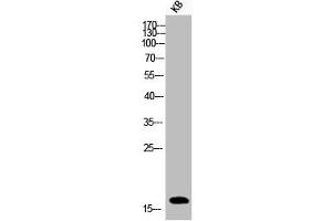 Western Blot analysis of KB cells using Phospho-Histone H3 (S10) Polyclonal Antibody (HIST1H3A/HIST2H3A/H3F3A (pSer10) anticorps)