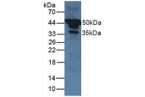 Western blot analysis of Human Serum. (SERPINA1 anticorps  (AA 25-418))