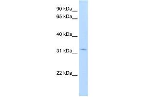 WB Suggested Anti-HSD17B6 Antibody Titration:  1. (HSD17B6 anticorps  (N-Term))
