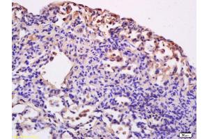 Formalin-fixed and paraffin embedded rat lung labeled with Anti-CD86/B7-2 Polyclonal Antibody, Unconjugated (ABIN736701) at 1:200 followed by conjugation to the secondary antibody and DAB staining.