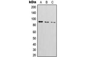 Western blot analysis of CD54 (pY512) expression in Saos2 (A), HepG2 TNFa-treated (B), Raji (C) whole cell lysates. (ICAM1 anticorps  (C-Term, pTyr512))