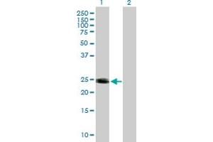 Western Blot analysis of HRAS expression in transfected 293T cell line by HRAS MaxPab polyclonal antibody. (HRAS anticorps  (AA 1-189))
