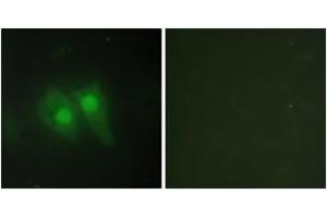 Immunofluorescence analysis of HeLa cells, using STEA3 Antibody.