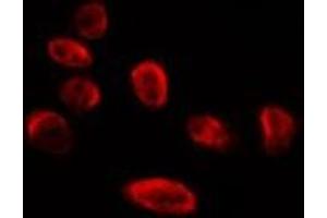 ABIN6275864 staining HepG2 by IF/ICC. (ERI1 anticorps  (C-Term))