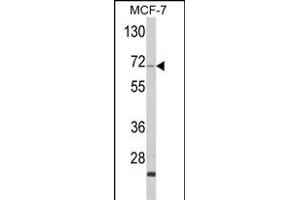Western blot analysis of ZYG11A Antibody (N-term) (ABIN652620 and ABIN2842414) in MCF-7 cell line lysates (35 μg/lane). (ZYG11A anticorps  (N-Term))