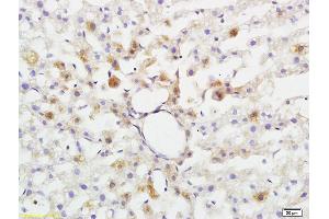 Formalin-fixed and paraffin embedded rat brain tissue labeled with Anti-ABHD5 Polyclonal Antibody, Unconjugated (ABIN708596) at 1:200 followed by conjugation to the secondary antibody and DAB staining