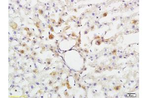 Formalin-fixed and paraffin embedded rat brain tissue labeled with Anti-ABHD5 Polyclonal Antibody, Unconjugated (ABIN708596) at 1:200 followed by conjugation to the secondary antibody and DAB staining (ABHD5 anticorps  (AA 281-349))