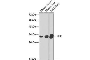 Western blot analysis of extracts of various cell lines using KHK Polyclonal Antibody at dilution of 1:1000. (Ketohexokinase anticorps)