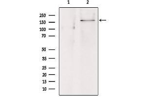 Western blot analysis of extracts from hepg2, using ABCC8 Antibody. (ABCC8 anticorps)