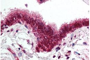 Human Lung, Respiratory Epithelium (formalin-fixed, paraffin-embedded) stained with SKIL antibody ABIN295508 at 5 ug/ml followed by biotinylated goat anti-rabbit IgG secondary antibody ABIN481713, alkaline phosphatase-streptavidin and chromogen. (SKIL anticorps  (AA 600-684))