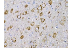 Immunohistochemistry of paraffin-embedded rat brain using NGF antibody (ABIN6293296) at dilution of 1:75 (40x lens). (Nerve Growth Factor anticorps)