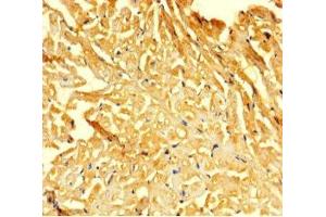 Immunohistochemistry of paraffin-embedded human heart tissue using ABIN7153046 at dilution of 1:100