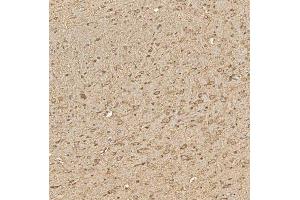 IHC analysis of SPTBN2 using anti-SPTBN2 antibody (ABIN7602111). (Spectrin, Beta, Non-erythrocytic 2 (SPTBN2) (AA 594-1909) anticorps)