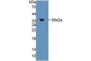 Detection of Recombinant CES1, Rat using Polyclonal Antibody to Carboxylesterase 1 (CES1)
