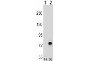 Western blot analysis of TGFBI antibody and 293 cell lysate either nontransfected (Lane 1) or transiently transfected (2) with the TGFBI gene. (TGFBI anticorps  (AA 106-135))