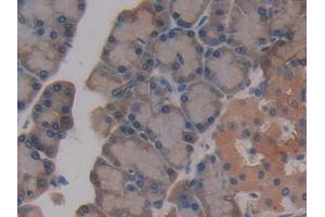 Detection of GSTt2 in Rat Pancreas Tissue using Polyclonal Antibody to Glutathione S Transferase Theta 2 (GSTt2)