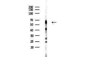 Western blot analysis of lysates from LoVo cells(heat-shock,45 min treatment), using KCNK10 Antibody at 1/1000 dilution.