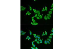 Immunofluorescence analysis of U2OS cells using MLN antibody (ABIN5973790). (Motilin anticorps)