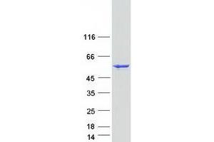 Validation with Western Blot