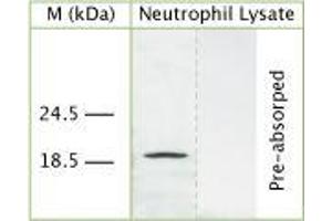 WB on human neutrophil lysate using Sheep antibody to human Cathelicidin antimicrobial peptide (CAP-18, hCAP-18, antibacterial protein LL-37, CAMP, CRAMP, FALL39): IgG (ABIN350187) at 50 µg/ml concentration.