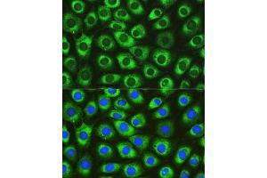 Immunofluorescence analysis of L929 cells using DN Rabbit pAb (ABIN6130306, ABIN6139717, ABIN6139719 and ABIN6215728) at dilution of 1:100. (DNAJC10 anticorps  (AA 614-793))