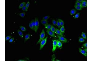 Immunofluorescent analysis of HepG2 cells using ABIN7142723 at dilution of 1:100 and Alexa Fluor 488-congugated AffiniPure Goat Anti-Rabbit IgG(H+L)