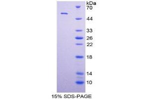 SDS-PAGE (SDS) image for Mitogen-Activated Protein Kinase 7 (MAPK7) (AA 560-793) protein (His tag,GST tag) (ABIN2123285) (MAPK7 Protein (AA 560-793) (His tag,GST tag))