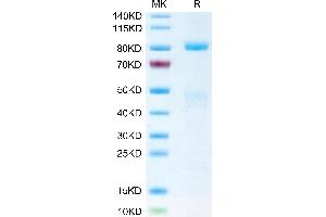 Biotinylated Human HGF R on Tris-Bis PAGE under reduced condition. (c-MET Protein (AA 25-932) (His-Avi Tag,Biotin))