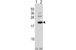 Western Blotting (WB) image for anti-BARX Homeobox 1 (BARX1) antibody (ABIN2998377) (BARX1 anticorps)