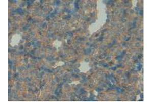 IHC-P analysis of Rat Spleen Tissue, with DAB staining. (IGFBP7 anticorps  (AA 88-281))
