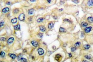 Image no. 1 for anti-Fibroblast Growth Factor Receptor 2 (FGFR2) antibody (ABIN265417) (FGFR2 anticorps)