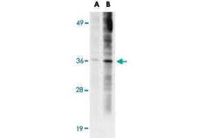 Western blot analysis of ST3GAL6 in HeLa cell lysate with ST3GAL6 polyclonal antibody  at (A) 1 and (B) 2 ug/mL . (ST3GAL6 anticorps  (C-Term))