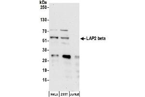 Western Blotting (WB) image for anti-LAP2 beta gamma/tmpo (AA 404-454) antibody (ABIN7453457) (LAP2 beta gamma/tmpo (AA 404-454) anticorps)