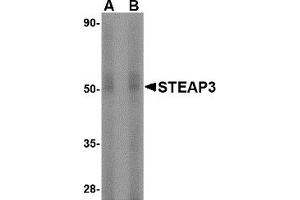 Western Blotting (WB) image for anti-STEAP Family Member 3, Metalloreductase (STEAP3) (N-Term) antibody (ABIN1031588) (STEAP3 anticorps  (N-Term))