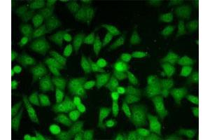 Immunofluorescent staining of HeLa cells with Glo1 monoclonal antibody, clone 6F10 . (GLO1 anticorps)