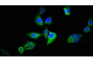 Immunofluorescence staining of HepG2 cells with ABIN7145113 at 1:133, counter-stained with DAPI. (ATG2B anticorps  (AA 1357-1536))