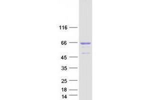 Validation with Western Blot (SRF Protein (Myc-DYKDDDDK Tag))