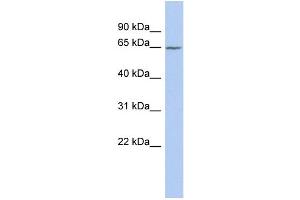 WB Suggested Anti-SLC25A12 Antibody Titration:  0.