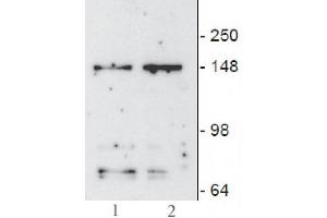 JMJD3/ KDM6B mAb (Clone 67-A2) tested by Western blot. (Kdm6b anticorps  (AA 1028-1684))