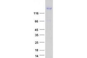 Validation with Western Blot